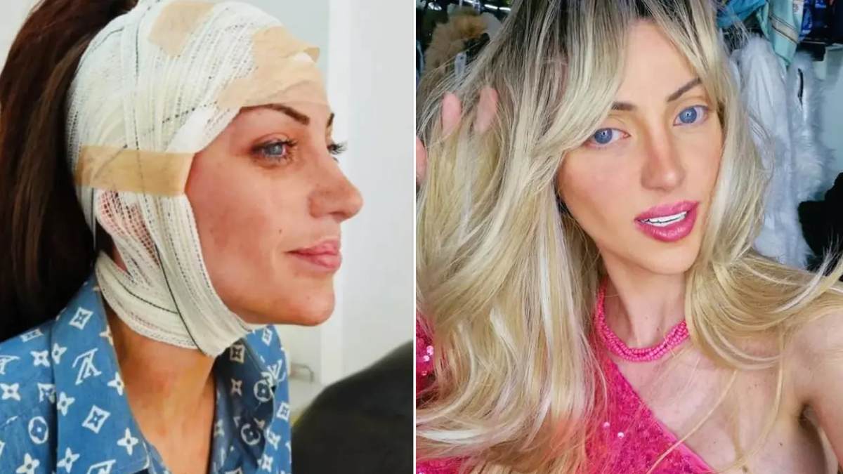 barbie bebege benzemek icin 27 kez ameliyat oldu brezilyali fenomen 31 yasinda hayatini kaybetti 8ApSNKaJ.jpg